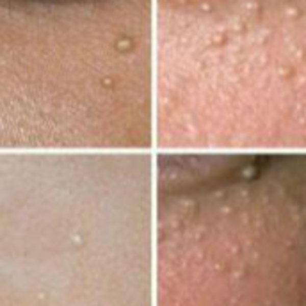 EXTRACCIONES DE MILIUMS