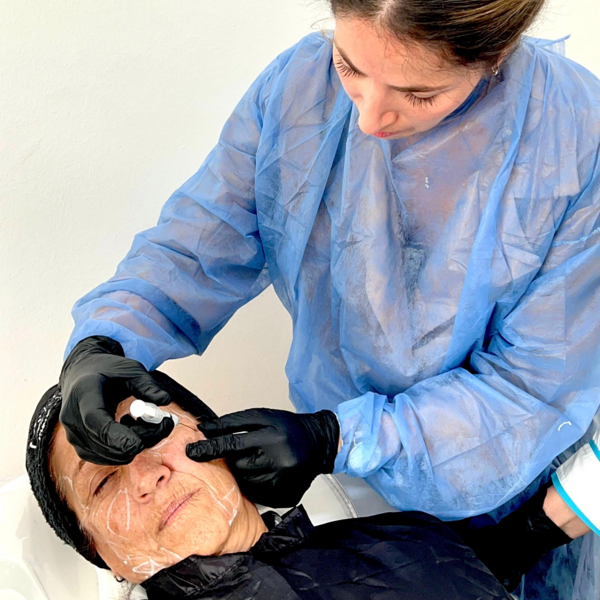 Bioestimulación con SCULPTRA facial x 1 ampolla