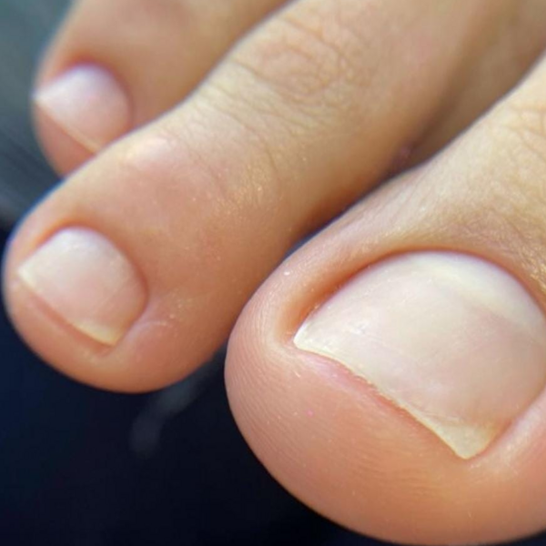 Reconstrucción de Uña