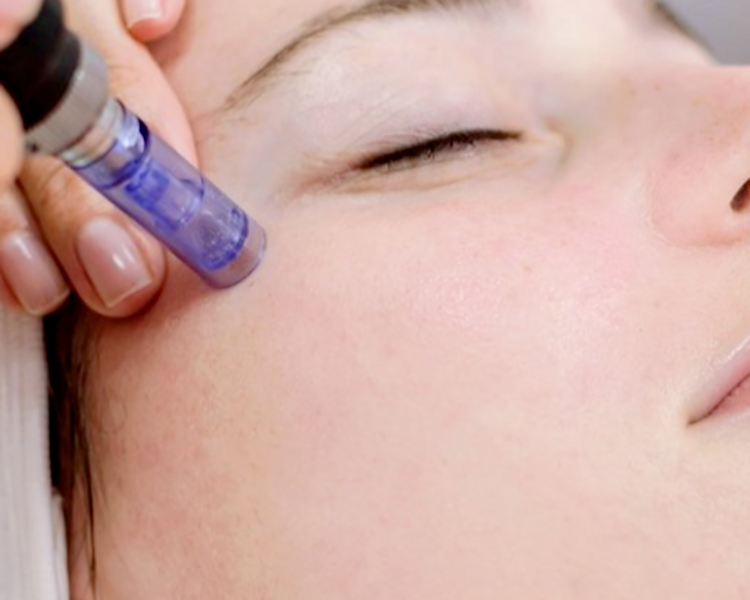 Dermapem $65.000 HASTA 3 CUOTAS s/INTERES