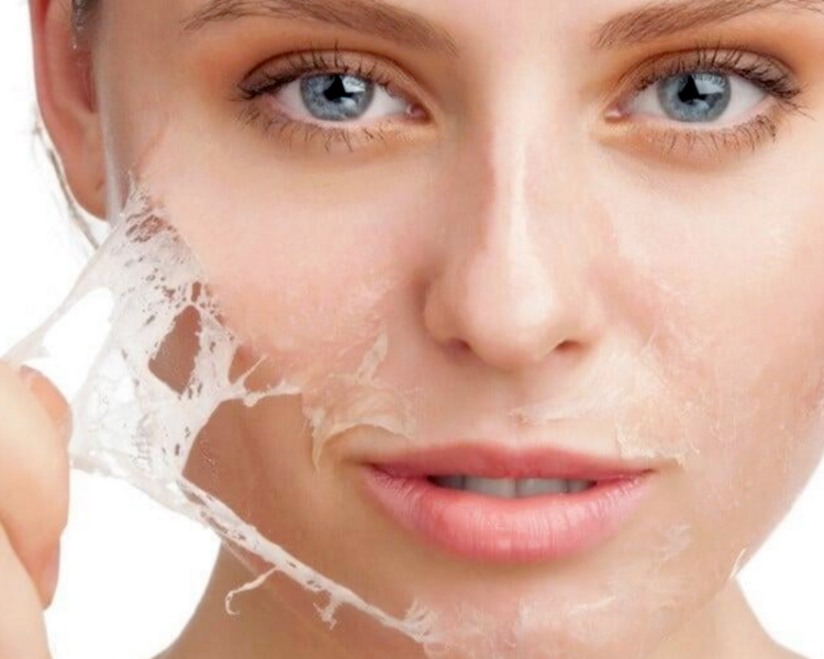 Peeling Químico o Enzmático Facial $65.000 HASTA 3 CUOTAS s/INTERES
