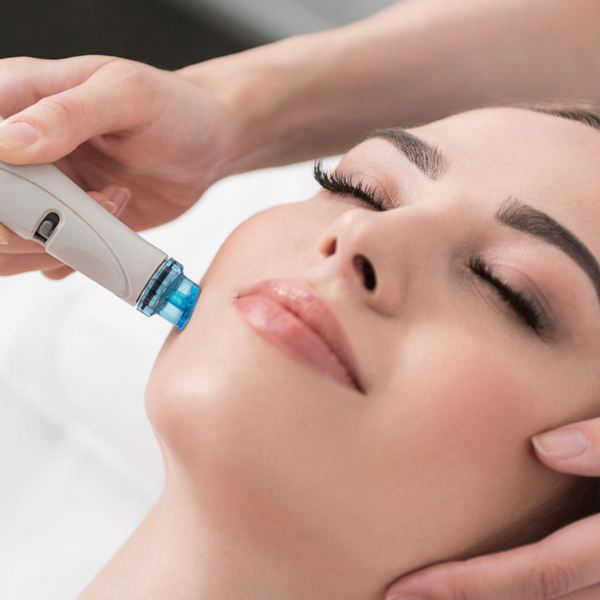 Hydra Peel x 1 Sesión