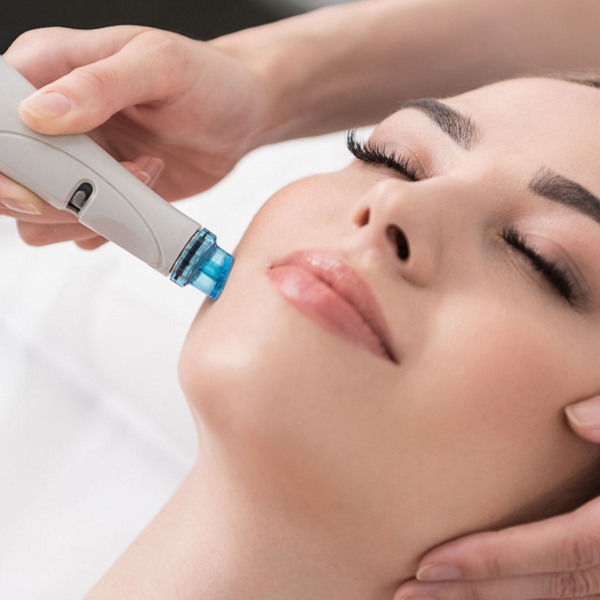 Hydra Peel (Pack x 4 sesiones) 