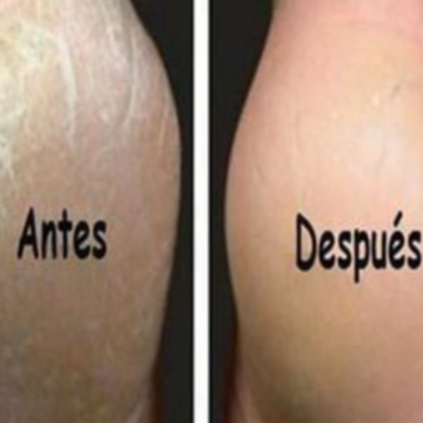 Podología  básica