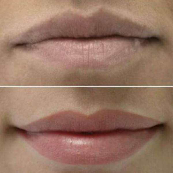 Labios Micropigmentación