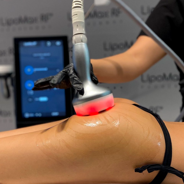 Paquete de 3 procedimientos Lipomax (12 sesiones)