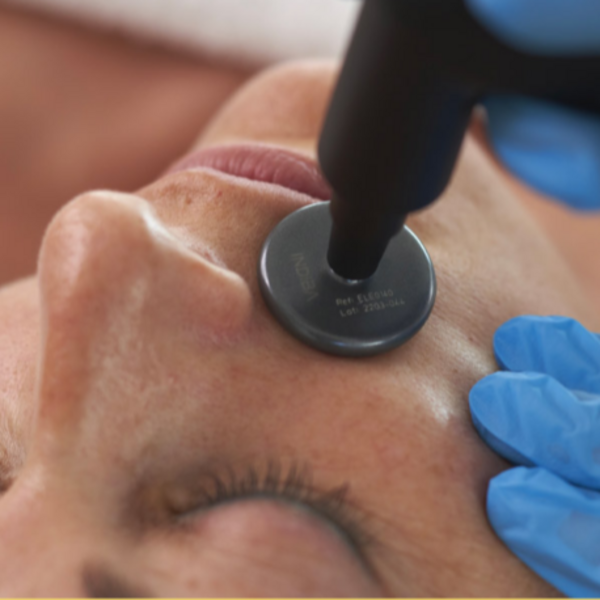 INDIBA® Facial (sesión individual)