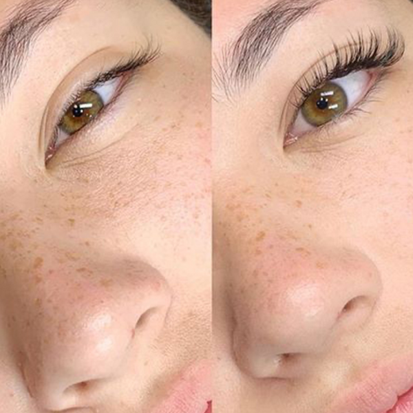 Extensiones Efecto natural