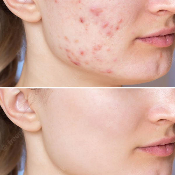 Peeling organico Zena Facial