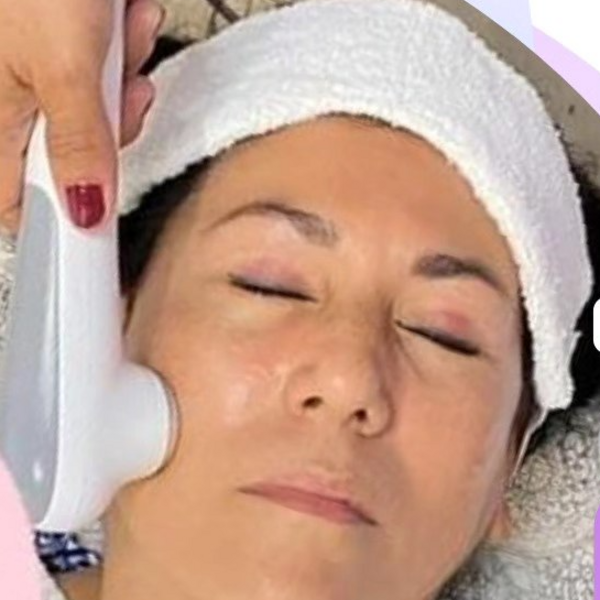 Ultrasonido facial 