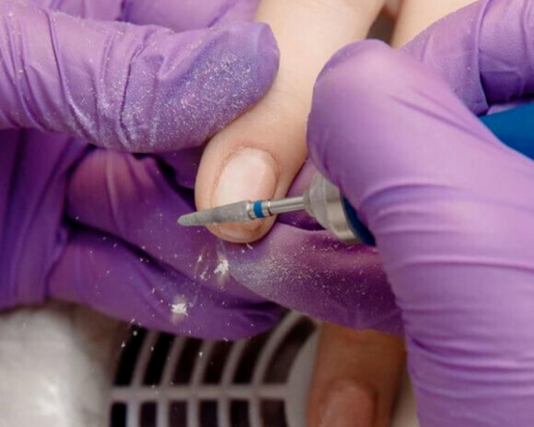 Retiro Permanente Otros