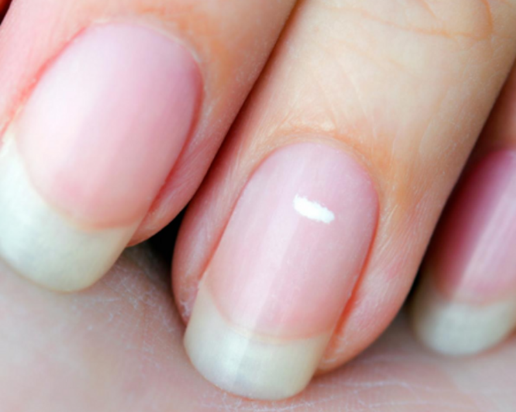 Retiro de acrílico con NUEVO SET