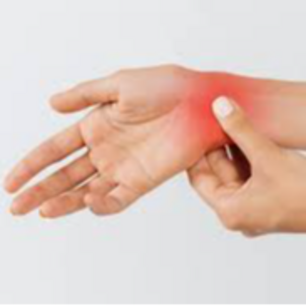 Tratamiento para túnel carpiano 