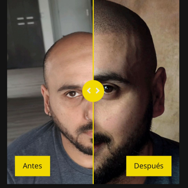 Retoque de Micropigmentacion Capilar