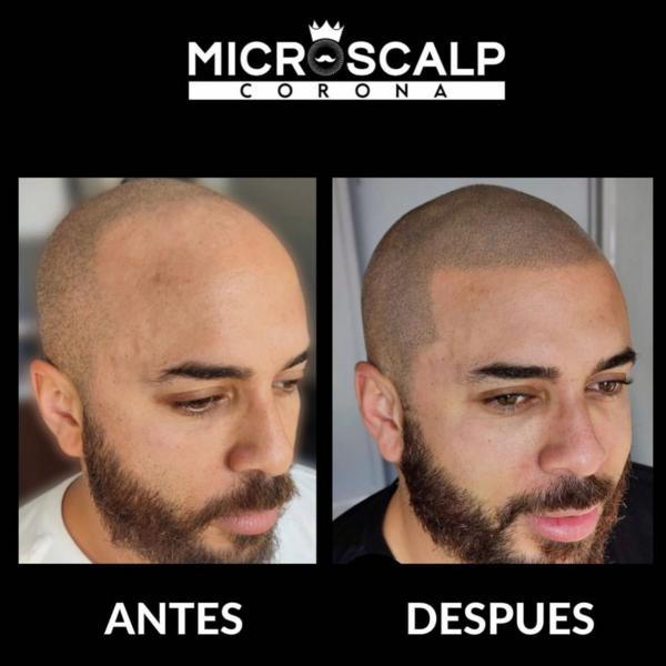 Evaluacion de Micropigmentacion Online