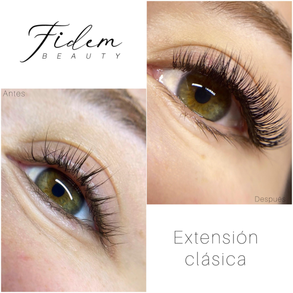 Extensión clásica 