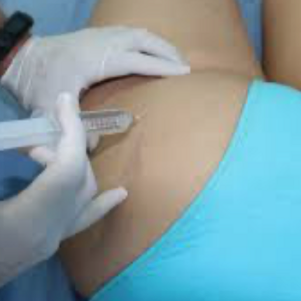 Celulitis Tratamiento de Ozono/ Cellulitis Ozone Treatment ( 6 sesiones)