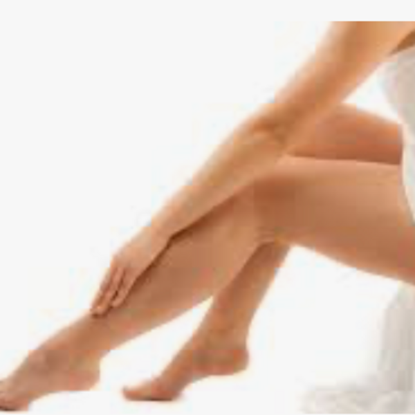 Varices /Varicose veins treatment