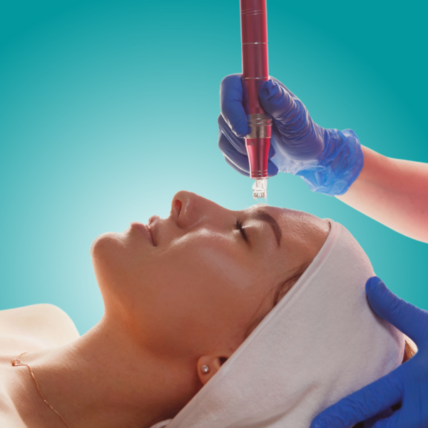 DERMAPEN/MICRONEEDLING PARA CICATRICES -  1 SESIÓN 