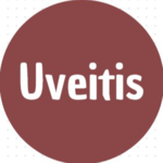 Uveitis
