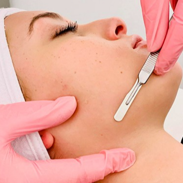 Dermaplaning