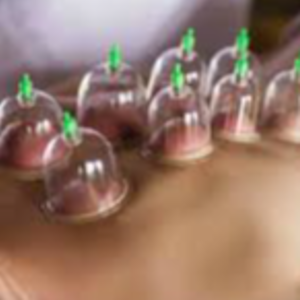 Masaje con Ventosas o estáticas. Valor por zona. 