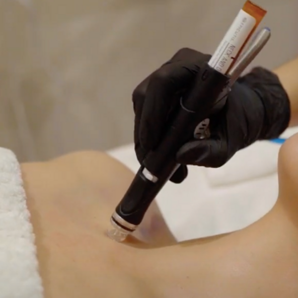 Hydrafacial Cuello y Escote - Epicutis