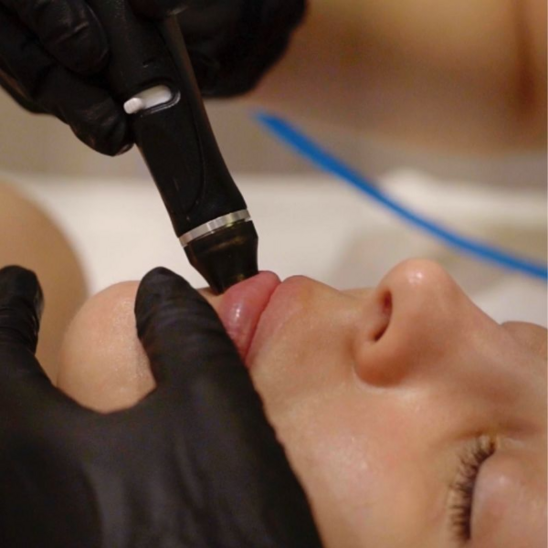 Hydrafacial Perk - Labios
