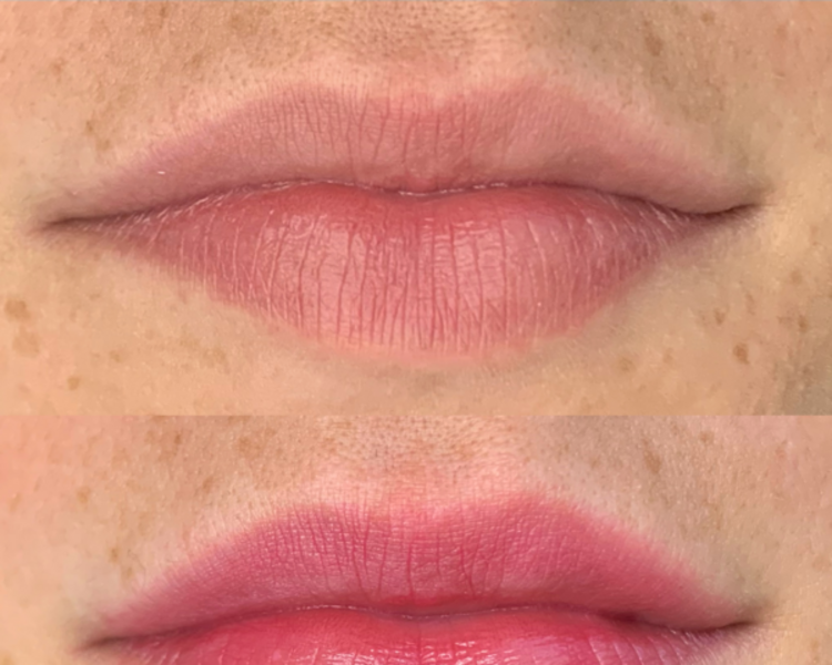 👄 Micropigmentación de Labios + Refuerzo