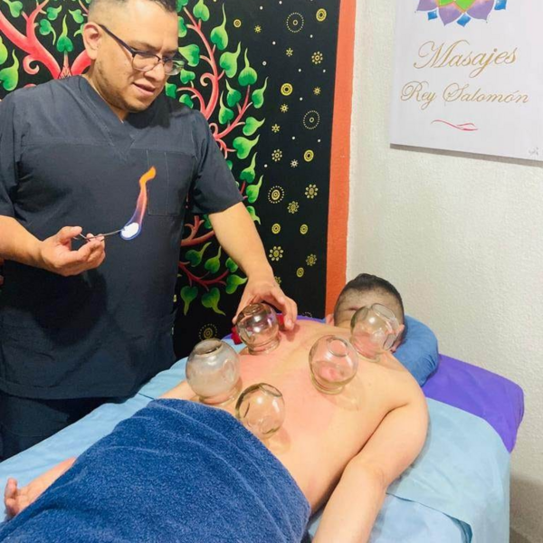 Terapia con Ventosas