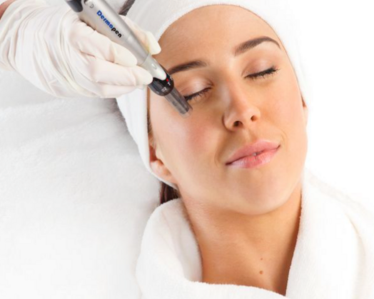 DERMAPEN / MICRONEEDLING (Hidratante, Antioxidante)