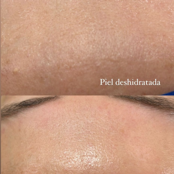 Limpieza profunda detox