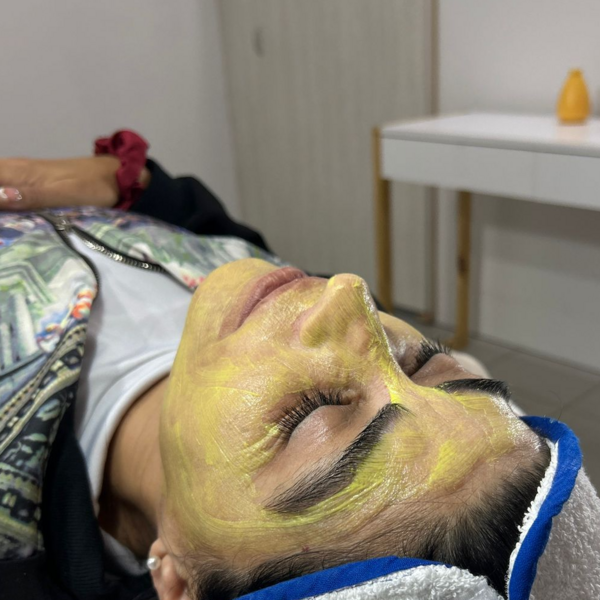 Yellow peel (Lee la descripción antes)