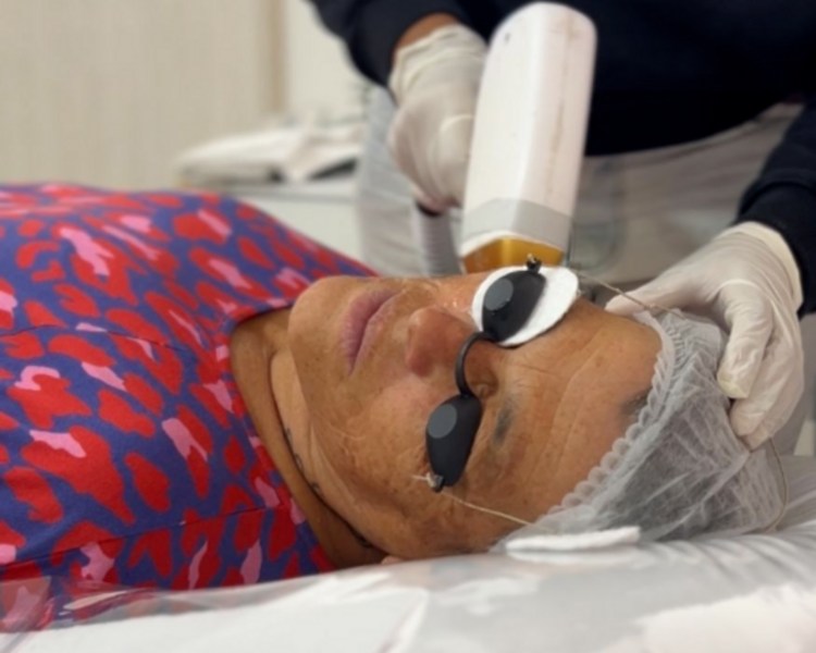 Cavado completo + Tira de cola