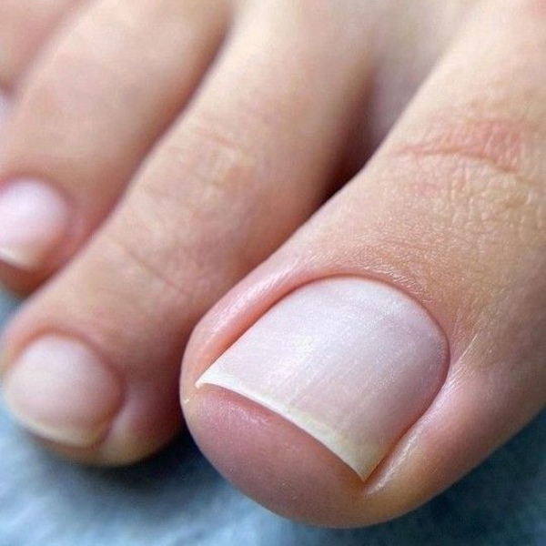 Retiro de acrilico sin nueva aplicación