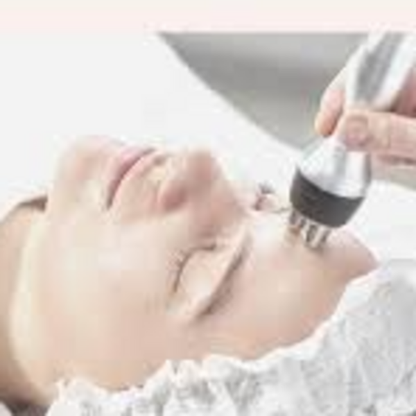Radiofrecuencia Facial