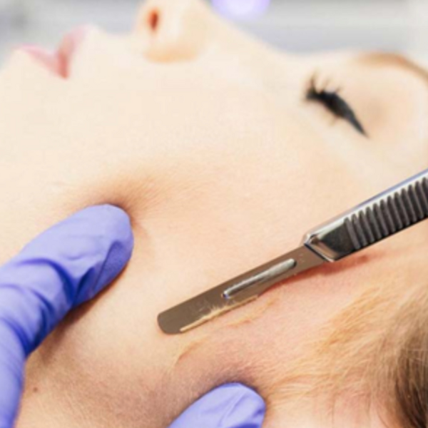Dermaplaning Facial