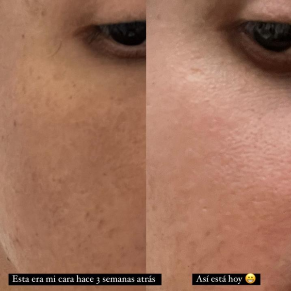 Asesoramiento de rutina de skincare (Online o presencial)