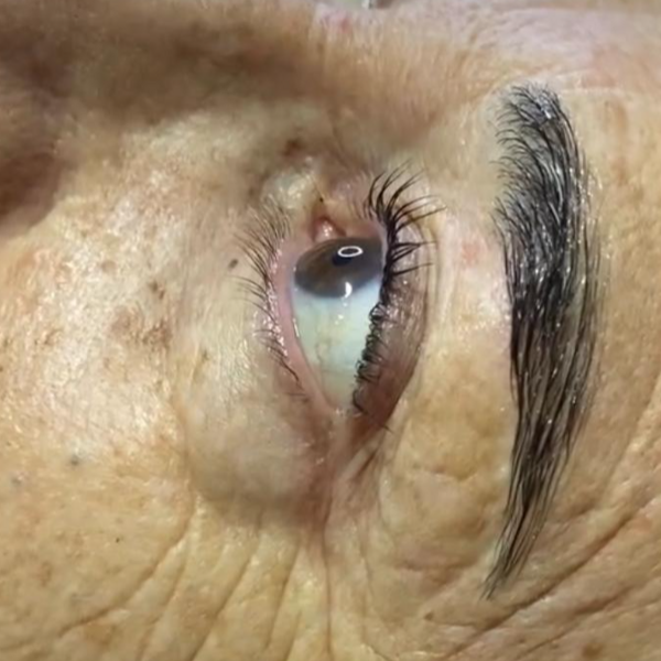 Lifting + Tinte o Botox