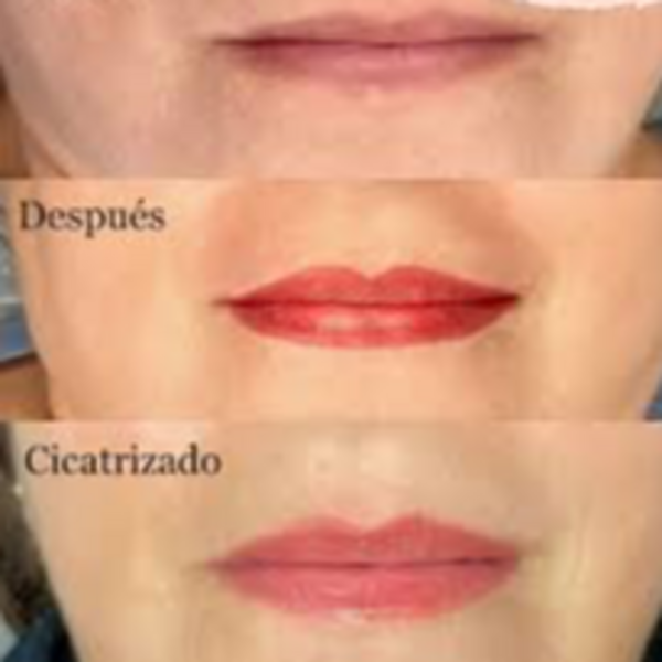  Retoque mensual Micropigmentación de labios