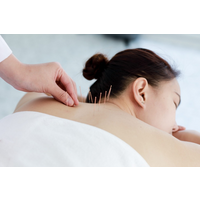 Huoli Acupuntura logo